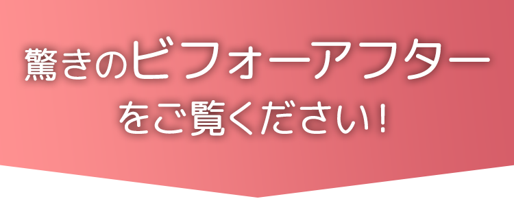 驚きのビフォーアフターをご覧ください！